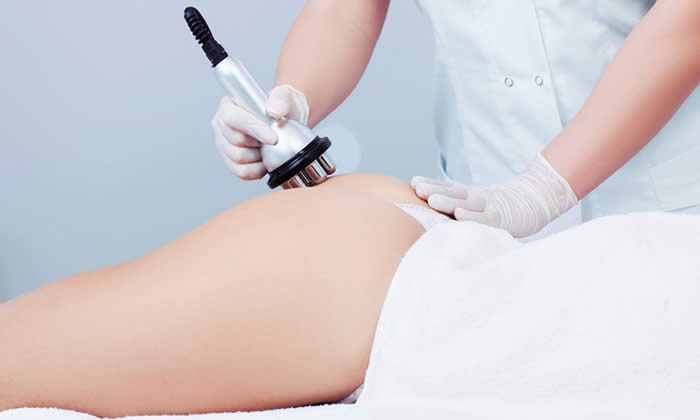 Radiofrequenza cellulite